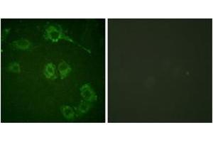 Image no. 1 for anti-Mitogen-Activated Protein Kinase Kinase Kinase 8 (MAP3K8) (AA 256-305) antibody (ABIN2888594)