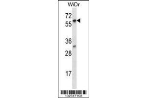 Image no. 1 for anti-La Ribonucleoprotein Domain Family, Member 7 (LARP7) (AA 527-556), (C-Term) antibody (ABIN656914)