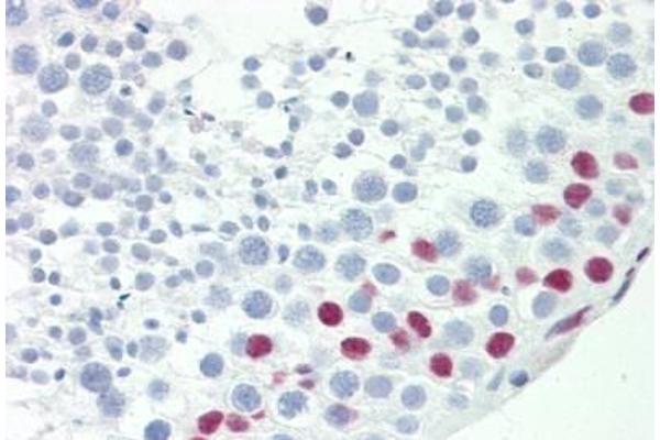 TCEAL3 antibody  (AA 15-43)