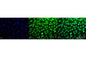 Image no. 6 for anti-Mitogen-Activated Protein Kinase 3 (MAPK3) antibody (PE) (ABIN2486925)