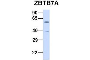 Image no. 2 for anti-Zinc Finger and BTB Domain Containing 7A (ZBTB7A) (N-Term) antibody (ABIN2780246)