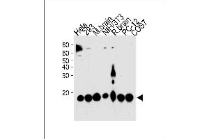 Image no. 2 for anti-Peptidylprolyl Cis/trans Isomerase, NIMA-Interacting 1 (PIN1) antibody (ABIN1882275)