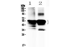 Image no. 1 for anti-S-Antigen, Retina and Pineal Gland (Arrestin) (SAG) (AA 193-405) antibody (ABIN5519058)