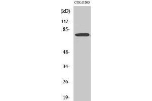 Image no. 2 for anti-Ewing Sarcoma Breakpoint Region 1 (EWSR1) (Internal Region) antibody (ABIN3184565)