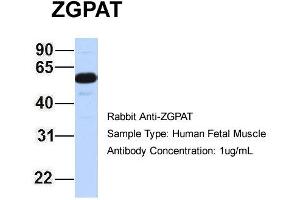 Image no. 3 for anti-Zinc Finger, CCCH-Type with G Patch Domain (ZGPAT) (Middle Region) antibody (ABIN2775555)