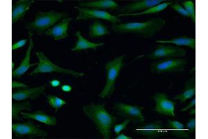 Image no. 3 for anti-Flavin Containing Monooxygenase 3 (FMO3) (AA 1-532) antibody (ABIN515768)