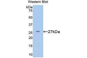 Image no. 1 for anti-FK506 Binding Protein 3, 25kDa (FKBP3) (AA 2-224) antibody (ABIN1078043)