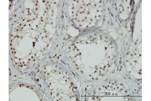 anti-Zinc Finger Protein 85 (ZNF85) (AA 2-76) antibody