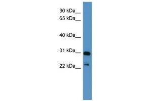 Image no. 1 for anti-Paired-Like Homeobox 2a (PHOX2A) (C-Term) antibody (ABIN2780651)