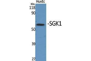 Image no. 3 for anti-serum/glucocorticoid Regulated Kinase 1 (SGK1) (Tyr1062) antibody (ABIN3186931)