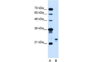 Image no. 1 for anti-Motile Sperm Domain Containing 3 (MOSPD3) (C-Term) antibody (ABIN2782063)