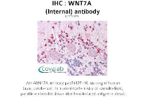 Image no. 1 for anti-Wingless-Type MMTV Integration Site Family, Member 7A (WNT7A) (Internal Region) antibody (ABIN1740836)