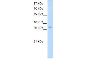 Image no. 1 for anti-K(lysine) Acetyltransferase 6B (KAT6B) (N-Term) antibody (ABIN927754)