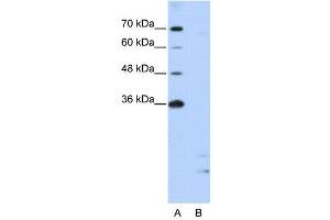 Image no. 2 for anti-Peptidylprolyl Isomerase E (Cyclophilin E) (PPIE) (Middle Region) antibody (ABIN2778967)