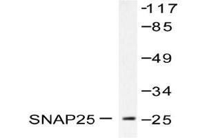 Image no. 1 for anti-Synaptosomal-Associated Protein, 25kDa (SNAP25) antibody (ABIN271818)