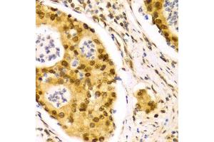 Image no. 7 for anti-ELAV (Embryonic Lethal, Abnormal Vision, Drosophila)-Like 1 (Hu Antigen R) (ELAVL1) antibody (ABIN3022231)