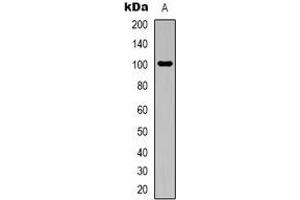 Image no. 3 for anti-Aconitase 1 (ACO1) (N-Term) antibody (ABIN2801378)