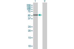 Western Blot analysis of ZNF436 expression in transfected 293T cell line by ZNF436 MaxPab polyclonal antibody.