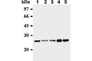 Image no. 1 for anti-MAD2 Mitotic Arrest Deficient-Like 1 (Yeast) (MAD2L1) antibody (ABIN567786)