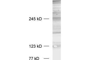 Image no. 2 for anti-Bassoon (BSN) (C-Term) antibody (ABIN1742310)