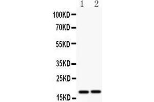 Image no. 2 for anti-Caspase 8 (CASP8) (AA 257-277), (N-Term) antibody (ABIN3044129)
