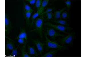 Immunofluorescence microscopy of Rabbit Anti-alpha-Tubulin antibody using HeLa cells fixed with PFA.