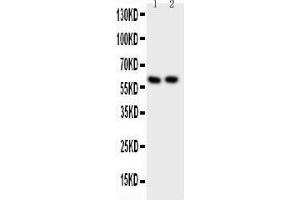 Image no. 3 for anti-Proto-oncogene tyrosine-protein kinase Src (Src) (AA 2-368) antibody (ABIN3043441)