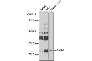 Image no. 2 for anti-Sal-Like 4 (SALL4) antibody (ABIN6147364)