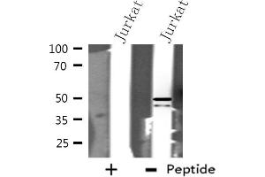 Western blot analysis of extracts from Jurkat cells using hnRNP H antibody.