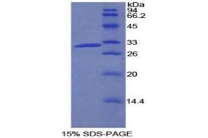 Image no. 1 for Phosphatidylinositol-4-Phosphate 3-Kinase, Catalytic Subunit Type 2 beta (PIK3C2B) (AA 790-1025) protein (His tag) (ABIN1878339)