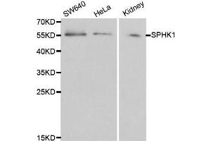 Image no. 1 for anti-Sphingosine Kinase 1 (SPHK1) antibody (ABIN3020648)