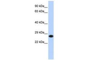 Image no. 1 for anti-Proteasome Subunit alpha 2 (PSMA2) (AA 36-85) antibody (ABIN6741386)