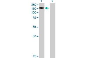Image no. 1 for anti-Splicing Factor, Arginine/serine-Rich 14 (SFRS14) (AA 1-988) antibody (ABIN523523)
