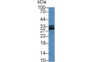 Image no. 2 for anti-Inhibitor of KB Kinase beta Interacting Protein (IKbIP) (AA 132-314) antibody (ABIN1859323)