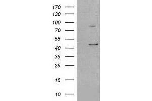 Image no. 2 for anti-serpin Peptidase Inhibitor, Clade B (Ovalbumin), Member 3 (SERPINB3) antibody (ABIN1500886)
