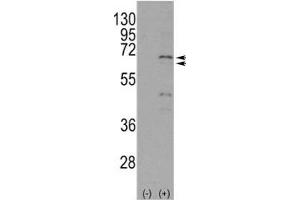 Western blot analysis of NUR77 antibody and 293 cell lysate either nontransfected (Lane 1) or transiently transfected with the NR4A1 gene (2).