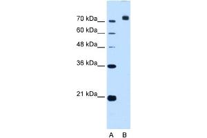 Image no. 1 for anti-Corin, Serine Peptidase (CORIN) (C-Term) antibody (ABIN2782723)