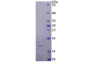 Image no. 5 for Fatty Acid Binding Protein 4, Adipocyte (FABP4) ELISA Kit (ABIN6730861)