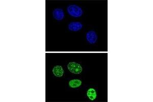 Image no. 2 for anti-Proliferating Cell Nuclear Antigen (PCNA) (AA 231-261) antibody (ABIN3032321)