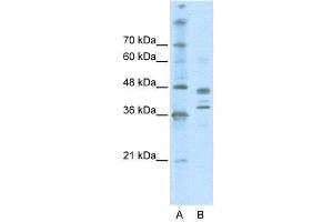 Image no. 2 for anti-SWI/SNF Related, Matrix Associated, Actin Dependent Regulator of Chromatin, Subfamily B, Member 1 (SMARCB1) (Middle Region) antibody (ABIN2778302)