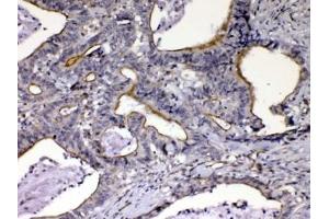 Image no. 4 for anti-Nephroblastoma Overexpressed (NOV) (AA 334-357) antibody (ABIN5647955)