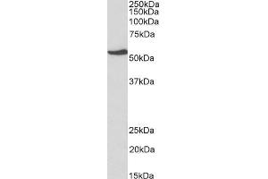 ABIN2851820 (1µg/ml) staining of HepG2 lysate (35µg protein in RIPA buffer).