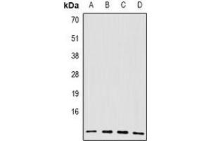 Image no. 2 for anti-Breast Cancer 2, Early Onset (BRCA2) antibody (ABIN2966476)