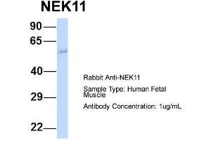 Image no. 4 for anti-NIMA (Never In Mitosis Gene A)-Related Kinase 11 (NEK11) (Middle Region) antibody (ABIN2783561)