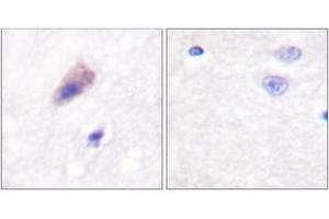 Image no. 2 for anti-Dynamin 1 (DNM1) (AA 740-789), (pSer774) antibody (ABIN1531269)