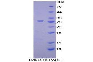 Image no. 1 for Calcium/calmodulin-Dependent Protein Kinase II gamma (CAMK2G) (AA 75-281) protein (His tag) (ABIN1879729)