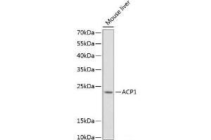Western blot analysis of extracts of Mouse liver using ACP1 Polyclonal Antibody at dilution of 1:1000.