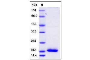 Image no. 1 for Chemokine (C-C Motif) Ligand 24 (CCL24) (AA 1-119) protein (His tag) (ABIN2003578)