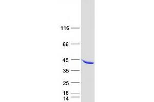 Image no. 1 for Neutrophil Cytosolic Factor 4, 40kDa (NCF4) (Transcript Variant 1) protein (Myc-DYKDDDDK Tag) (ABIN2726889)