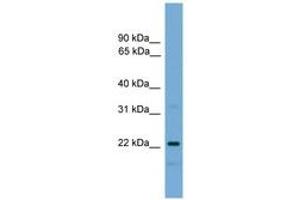 Image no. 1 for anti-Nicotinamide Riboside Kinase 1 (NMRK1) (AA 35-84) antibody (ABIN6745625)